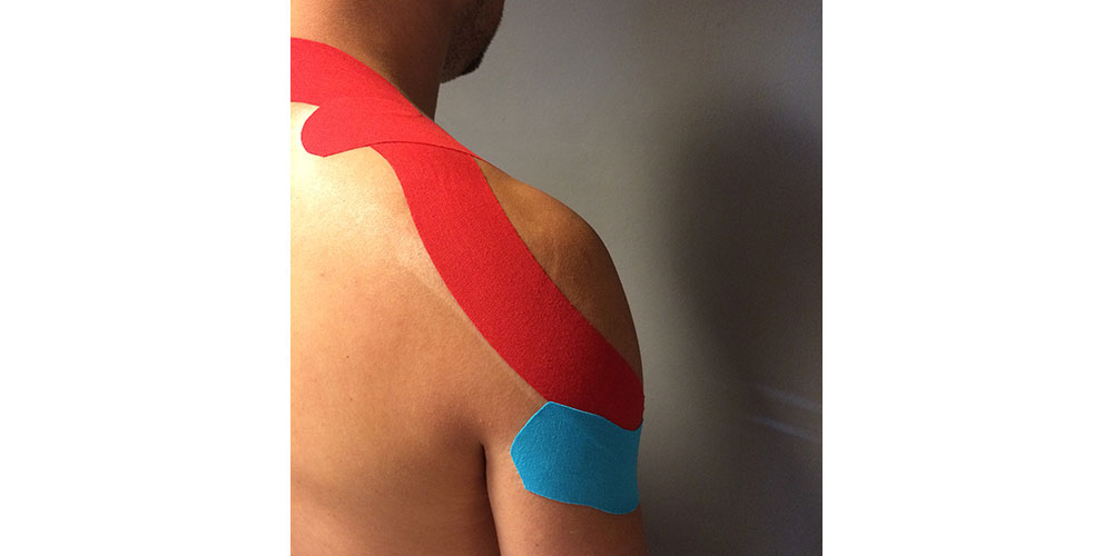 Medical Taping bij Fysiotherapie Mill